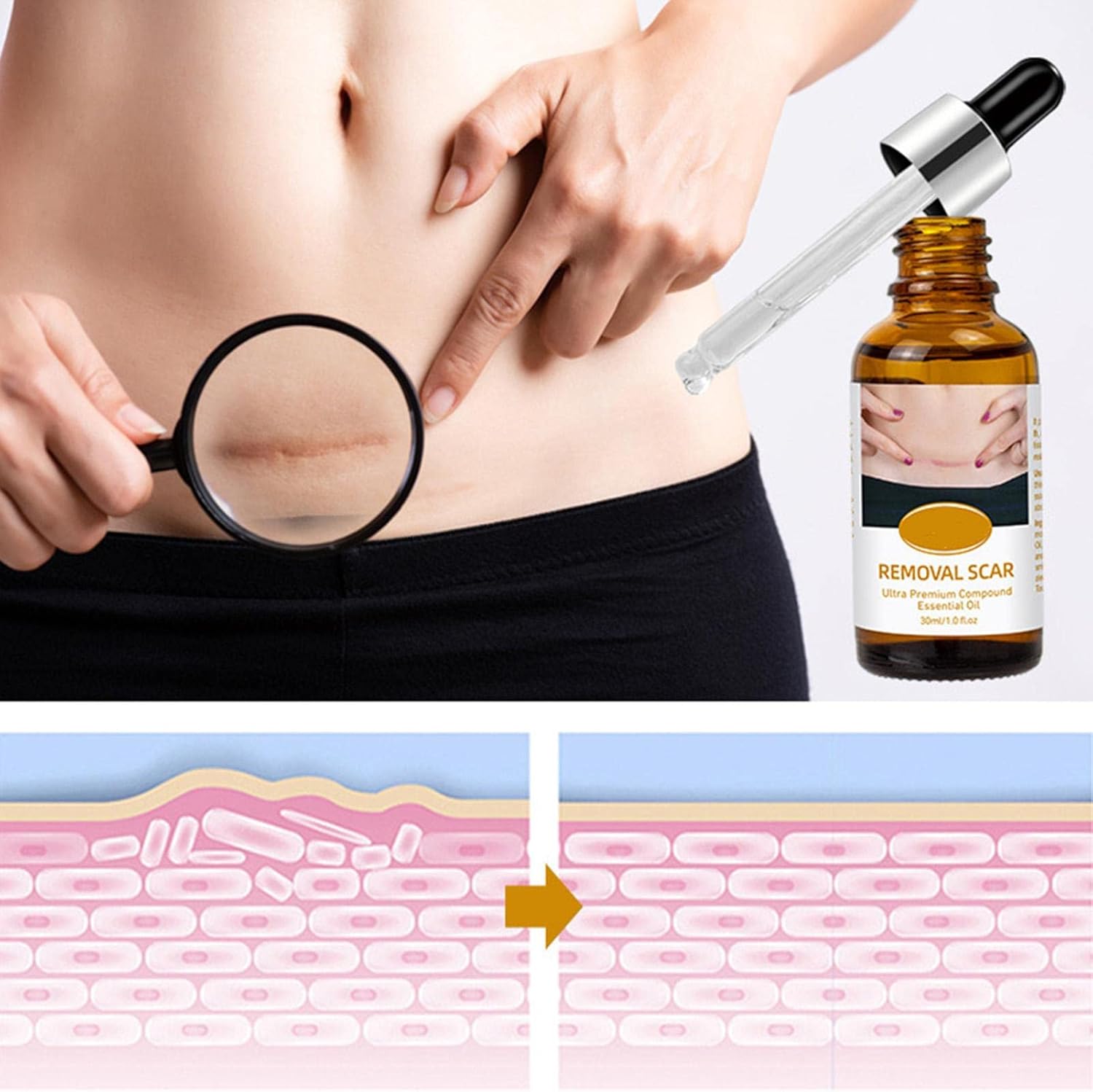 Acne Scar Removal Rejuvenation Serum | Scar, C section &amp; Stretch Mark Removal Oil for women