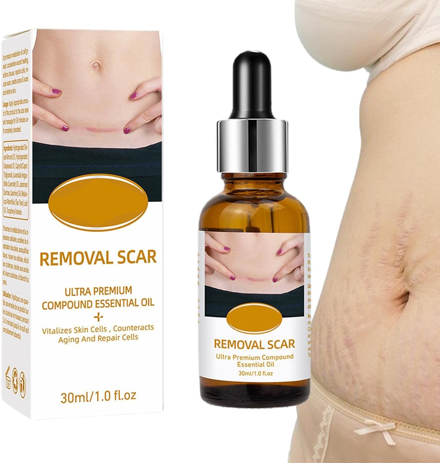 Acne Scar Removal Rejuvenation Serum | Scar, C section &amp; Stretch Mark Removal Oil for women
