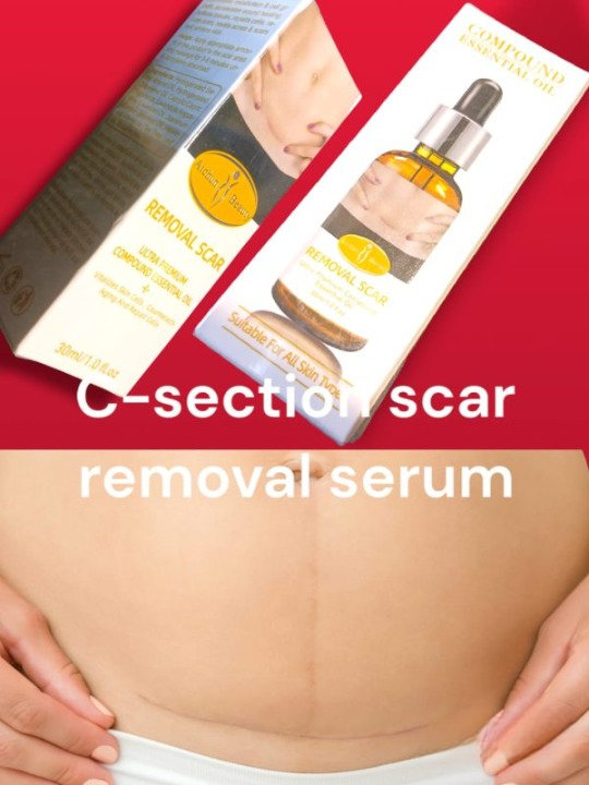 Acne Scar Removal Rejuvenation Serum | Scar, C section &amp; Stretch Mark Removal Oil for women
